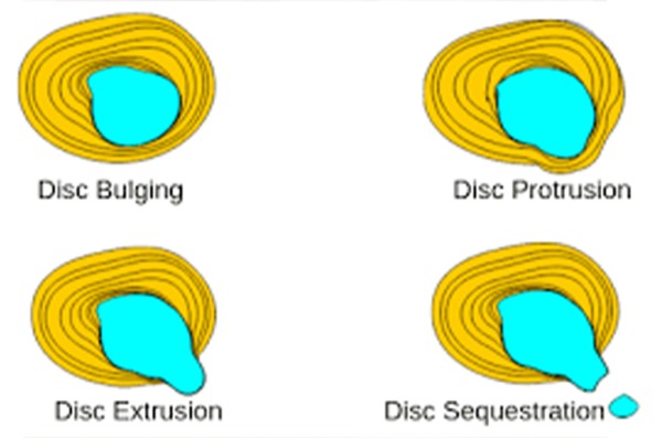 1cfd01862c754de5fcc0d46c872e7876_1697006184_0934.jpg